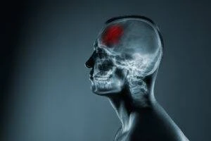 costs-hiring-brain-injury-lawyer