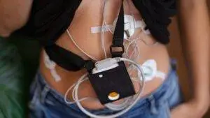 a woman with medical devices attached to her abdomen
