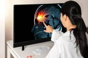 Female doctor looks at screen showing brain damage.