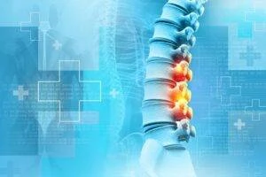 Illustration showing a human spinal cord injury, highlighting back pain areas and their impact on mobility. This image helps explain 'What is a Spinal Cord Injury?' by visually representing the complexities of spinal injuries and their effects on the body.