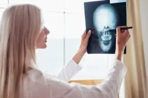 doctor examining head x-ray