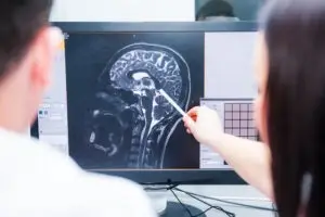 doctors reviewing brain scans