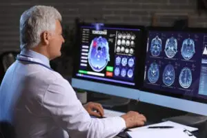 neurologist reviewing mri of human head