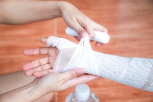 burn victim getting hand taped up