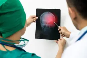 Fort Myers Traumatic Brain Injury (TBI) Lawyer