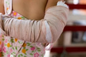 little girl with a broken arm