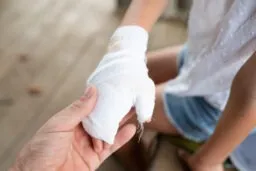 Warrenton Burn Injury Lawyer