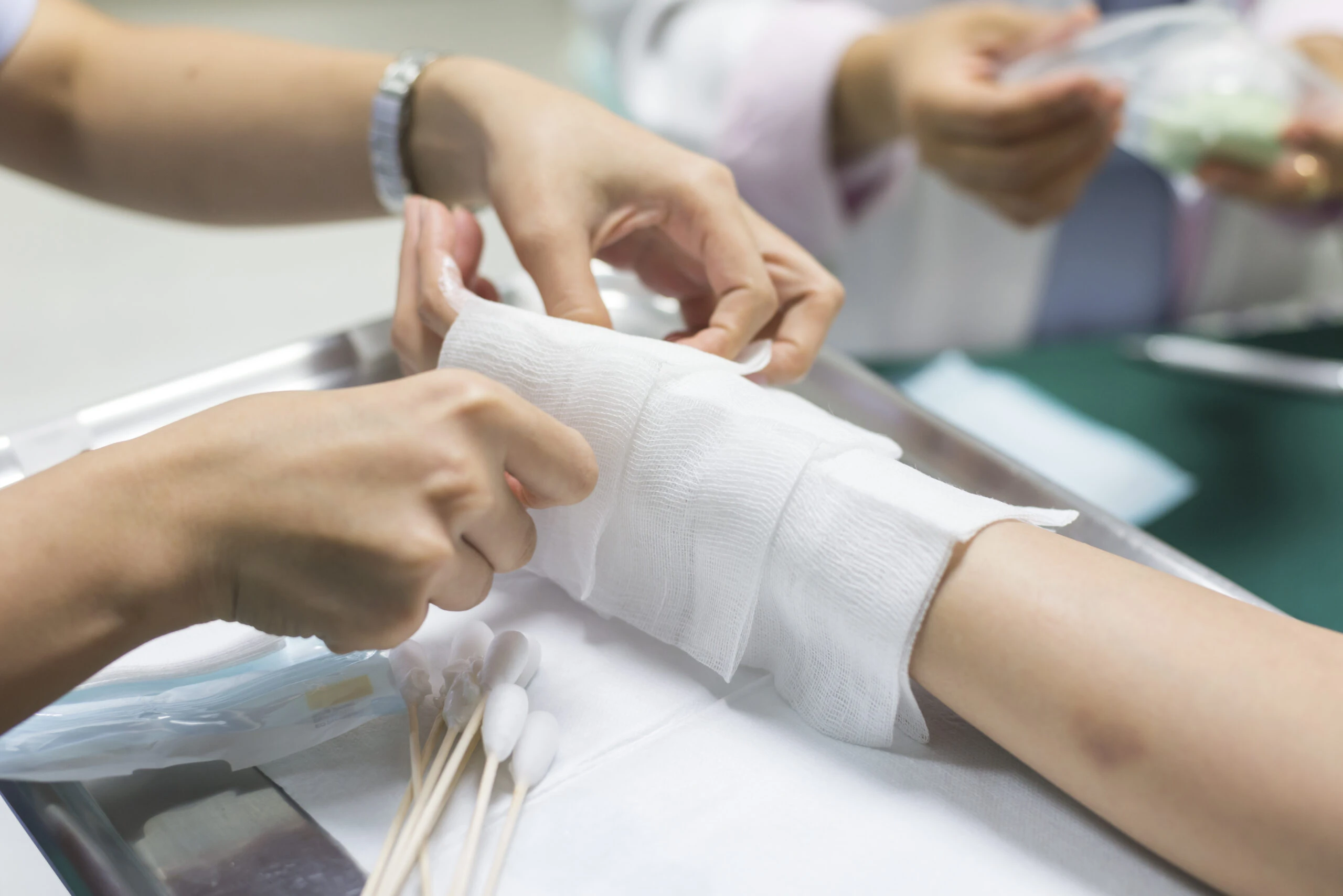 Discover how a burn injury attorney in Elk Grove can help you recover fair compensation following an injury.