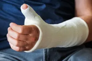 man with cast on broken or fractured arm