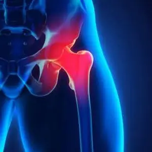 fort myers hip injury lawyer